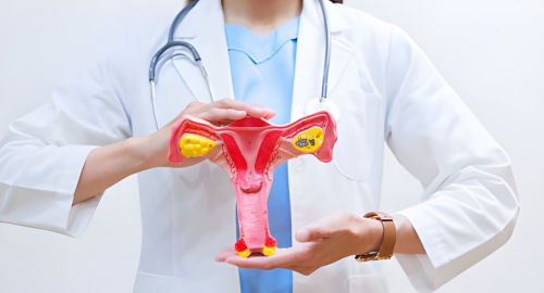 Tumore ovarico, una donna su tre attende oltre un anno per la diagnosi